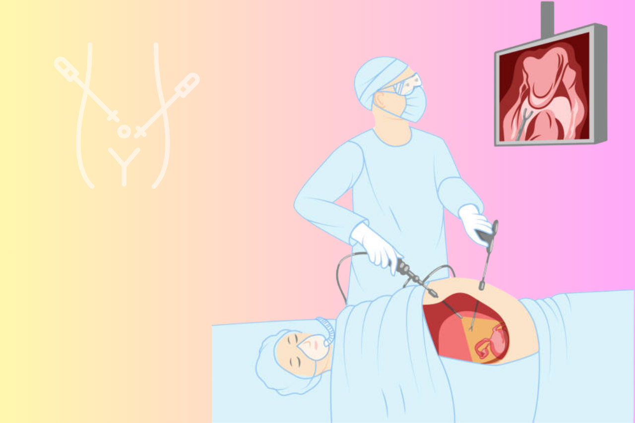 Laparoscopic Surgery for Infertility: Minimally Invasive Care at Ashakiran Hospital Pune